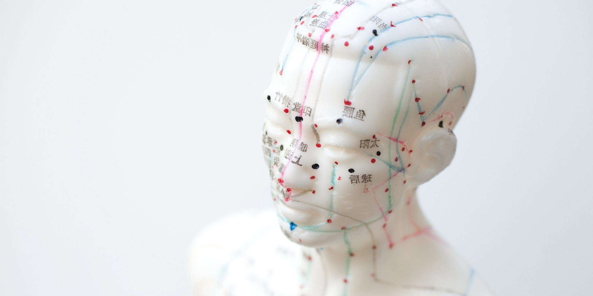 Acupuncture