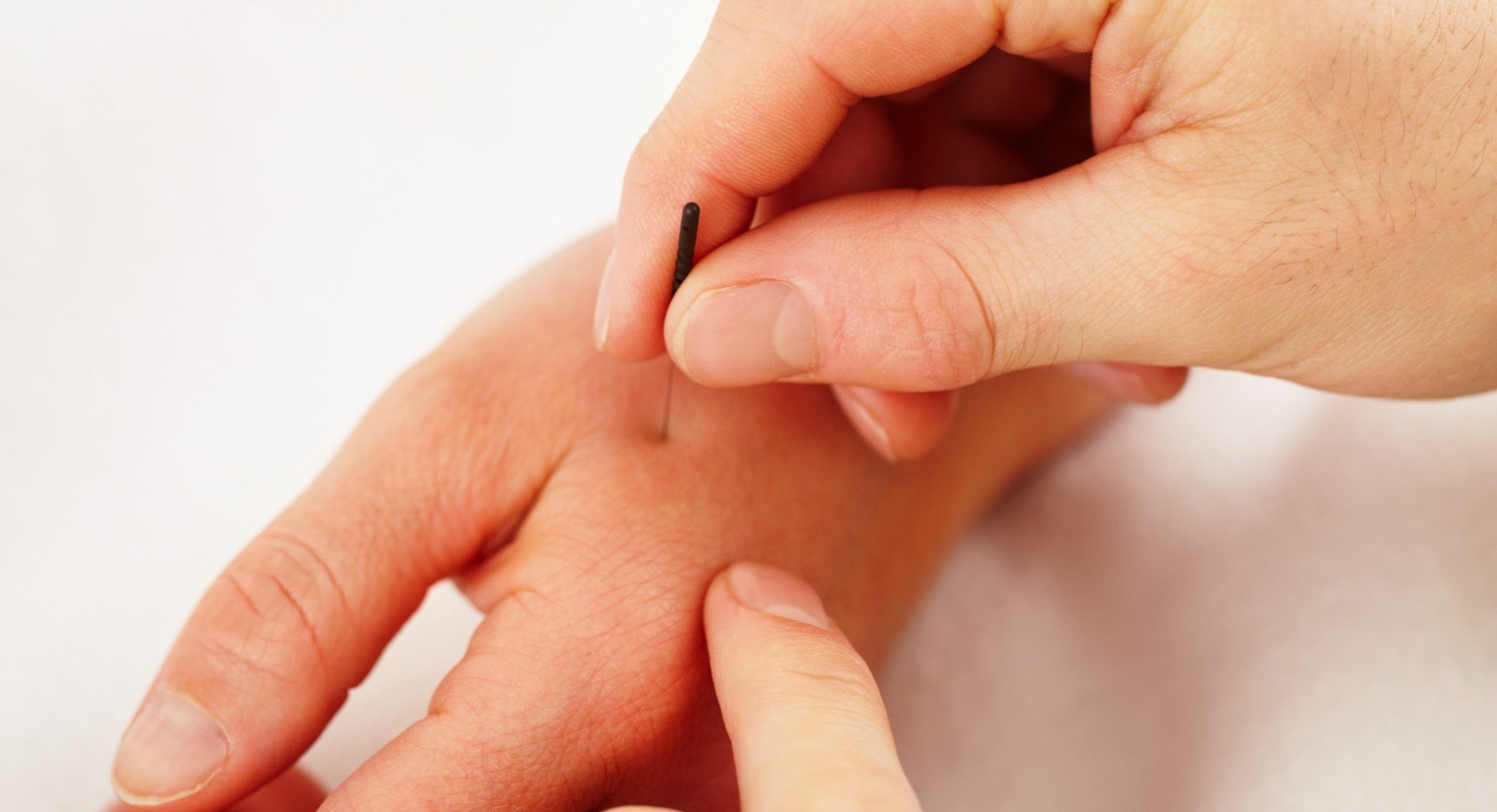 Woman receiving alternative medicine